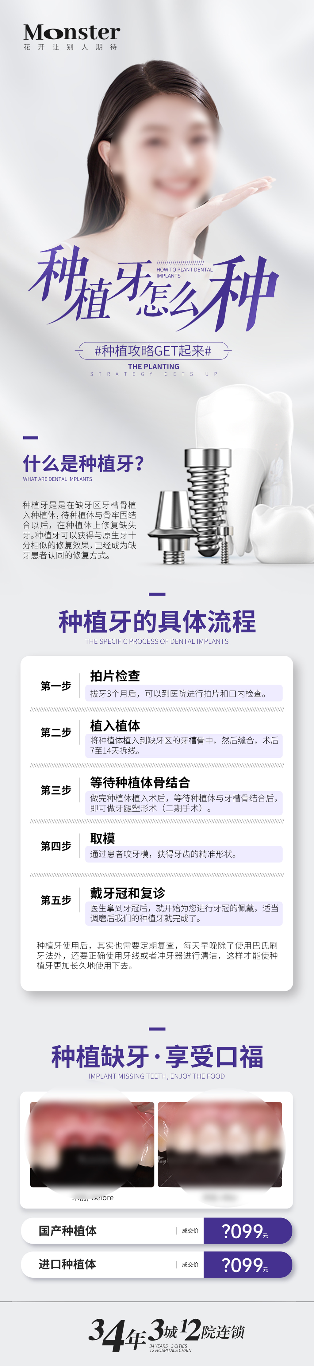 种植牙介绍微信长图 种植牙介绍微信长图